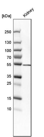 SHMT1 Antibody in Western Blot (WB)