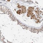 TSTA3 Antibody in Immunohistochemistry (Paraffin) (IHC (P))