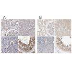 PCM1 Antibody