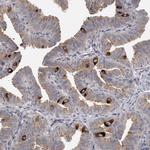 PCM1 Antibody in Immunohistochemistry (IHC)