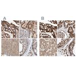 MRPL45 Antibody in Immunohistochemistry (IHC)