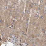 MRPL45 Antibody in Immunohistochemistry (IHC)