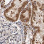 MRPL45 Antibody in Immunohistochemistry (IHC)