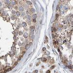 MRPL45 Antibody in Immunohistochemistry (IHC)