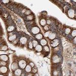 MRPL45 Antibody in Immunohistochemistry (IHC)