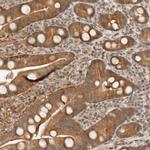 ARFGEF1 Antibody in Immunohistochemistry (Paraffin) (IHC (P))