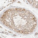 ARFGEF1 Antibody in Immunohistochemistry (Paraffin) (IHC (P))