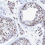 GLT6D1 Antibody in Immunohistochemistry (Paraffin) (IHC (P))