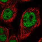 DDX42 Antibody in Immunocytochemistry (ICC/IF)