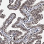 DDX42 Antibody in Immunohistochemistry (IHC)