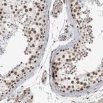 DDX42 Antibody in Immunohistochemistry (IHC)