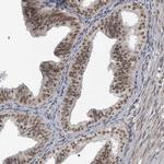 DDX42 Antibody in Immunohistochemistry (IHC)