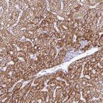 ZNF101 Antibody in Immunohistochemistry (Paraffin) (IHC (P))