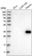 ZNF101 Antibody in Western Blot (WB)