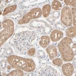 HRSP12 Antibody in Immunohistochemistry (Paraffin) (IHC (P))