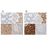 HRSP12 Antibody in Immunohistochemistry (IHC)