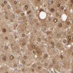 HRSP12 Antibody in Immunohistochemistry (IHC)