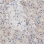 HRSP12 Antibody in Immunohistochemistry (IHC)