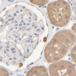 HRSP12 Antibody in Immunohistochemistry (IHC)