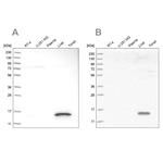 HRSP12 Antibody in Western Blot (WB)