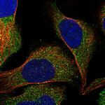 RUNDC3A Antibody in Immunocytochemistry (ICC/IF)