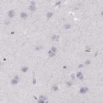 RUNDC3A Antibody in Immunohistochemistry (IHC)