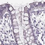 RUNDC3A Antibody in Immunohistochemistry (IHC)