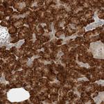 CtBP2 Antibody in Immunohistochemistry (Paraffin) (IHC (P))