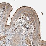 CtBP2 Antibody in Immunohistochemistry (Paraffin) (IHC (P))