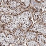 DDX42 Antibody in Immunohistochemistry (Paraffin) (IHC (P))