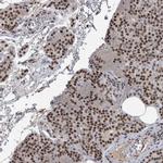 DDX42 Antibody in Immunohistochemistry (IHC)