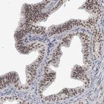 DDX42 Antibody in Immunohistochemistry (IHC)