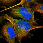 NAA15 Antibody in Immunocytochemistry (ICC/IF)