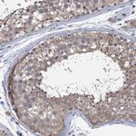 NAA15 Antibody in Immunohistochemistry (Paraffin) (IHC (P))