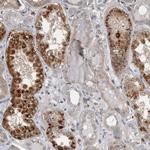 CTBS Antibody in Immunohistochemistry (Paraffin) (IHC (P))