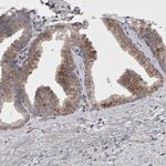 CTBS Antibody in Immunohistochemistry (Paraffin) (IHC (P))