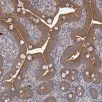 CTBS Antibody in Immunohistochemistry (IHC)