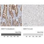 CDH17 Antibody in Immunohistochemistry (IHC)