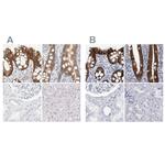 CDH17 Antibody in Immunohistochemistry (IHC)