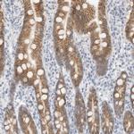 CDH17 Antibody in Immunohistochemistry (IHC)