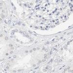 CDH17 Antibody in Immunohistochemistry (IHC)