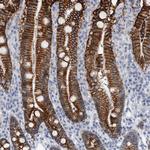 CDH17 Antibody in Immunohistochemistry (Paraffin) (IHC (P))