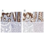 CDH17 Antibody in Immunohistochemistry (IHC)