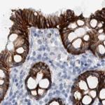 CDH17 Antibody in Immunohistochemistry (IHC)