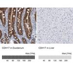 CDH17 Antibody