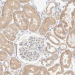 NT5C Antibody in Immunohistochemistry (Paraffin) (IHC (P))