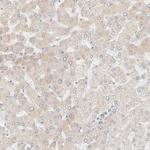 NT5C Antibody in Immunohistochemistry (Paraffin) (IHC (P))