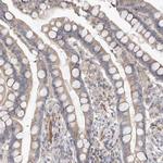 UNK Antibody in Immunohistochemistry (Paraffin) (IHC (P))