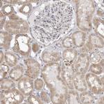 UNK Antibody in Immunohistochemistry (Paraffin) (IHC (P))