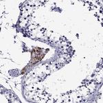 STAR Antibody in Immunohistochemistry (IHC)